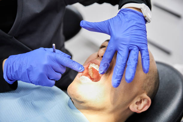 Best After-Hours Emergency Dentist in Barberton, WA